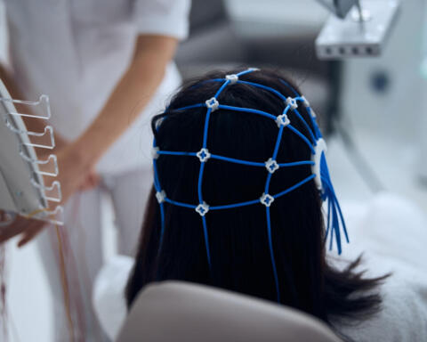 Un'interfaccia cervello-computer permette ai pazienti affetti da SLA di parlare