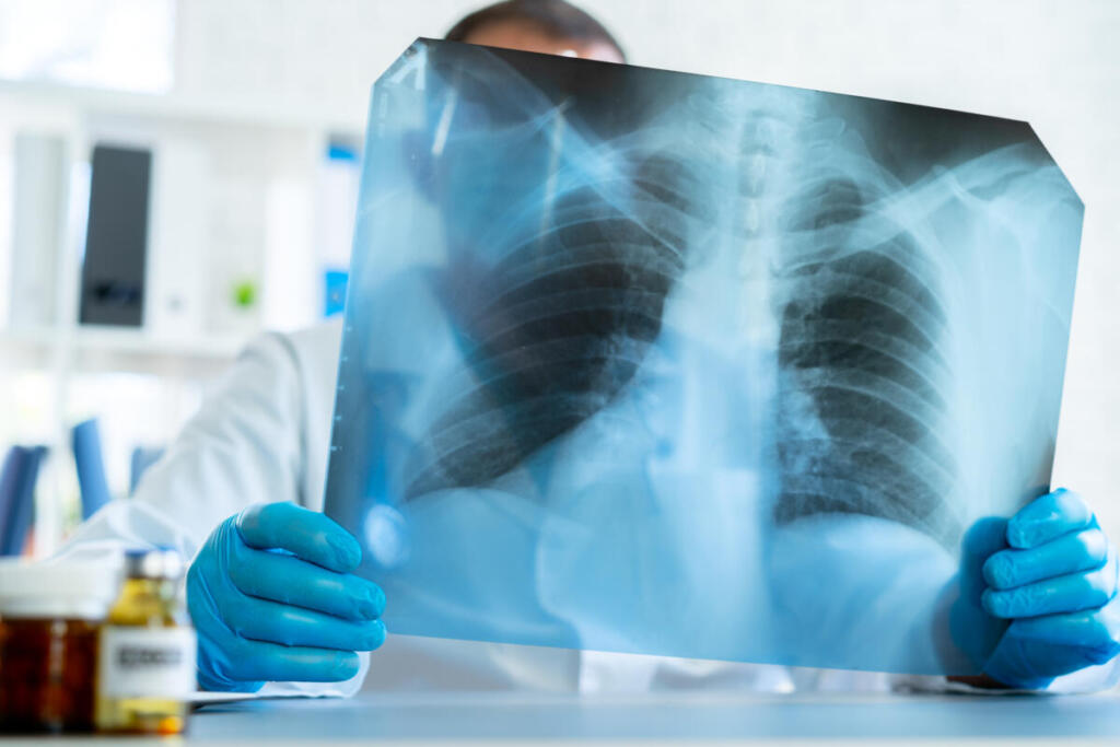PerCORSA di Salute riparte dalle piazze: screening gratuiti e prevenzione per le malattie respiratorie